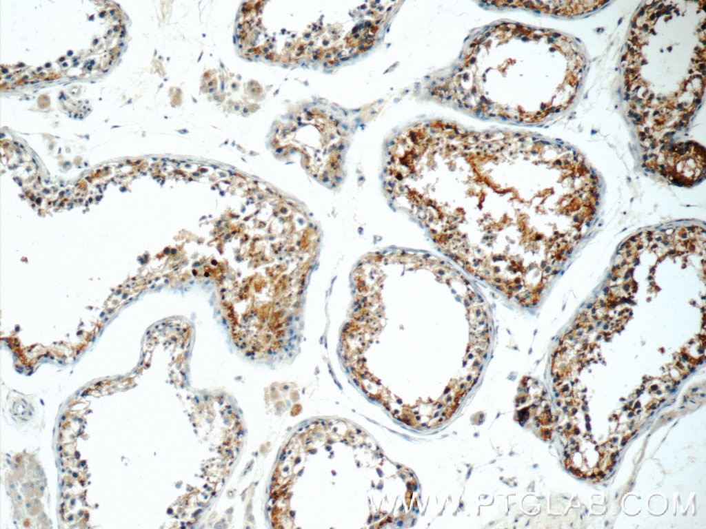 Immunohistochemistry (IHC) staining of human testis tissue using IFT27 Polyclonal antibody (15017-1-AP)
