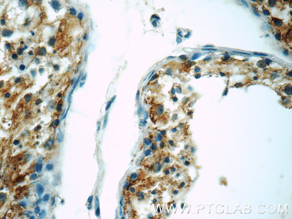 Immunohistochemistry (IHC) staining of human testis tissue using IFT27 Polyclonal antibody (15017-1-AP)