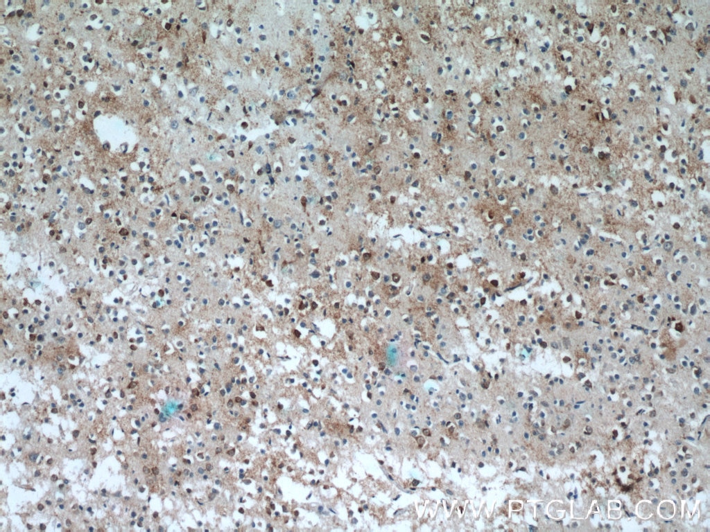 Immunohistochemistry (IHC) staining of human brain tissue using IFT27 Polyclonal antibody (15017-1-AP)