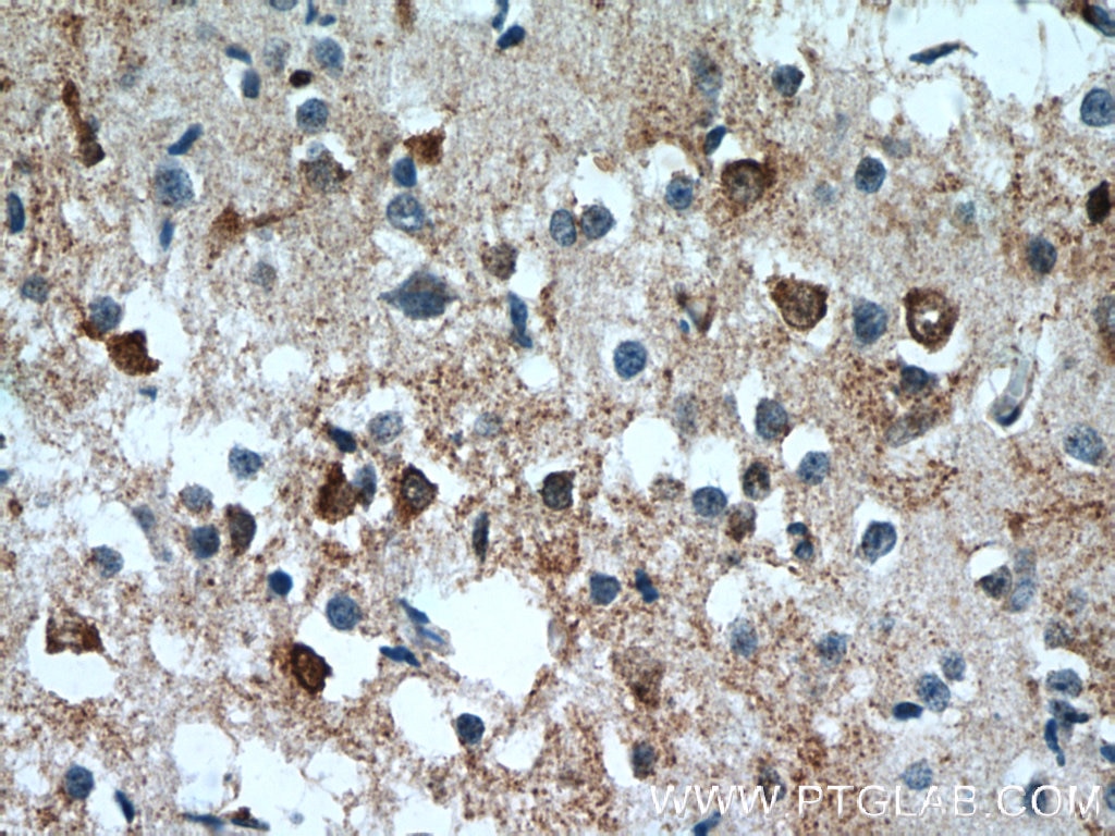 Immunohistochemistry (IHC) staining of human brain tissue using IFT27 Polyclonal antibody (15017-1-AP)