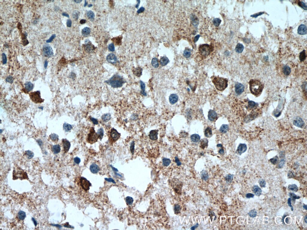 IHC staining of human brain using 15017-1-AP