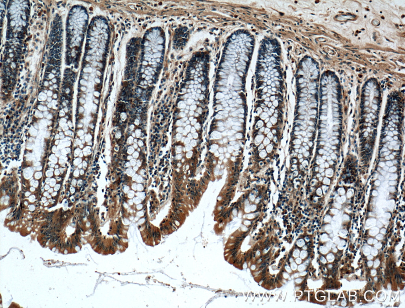 Immunohistochemistry (IHC) staining of human colon tissue using IFT22 Polyclonal antibody (26896-1-AP)