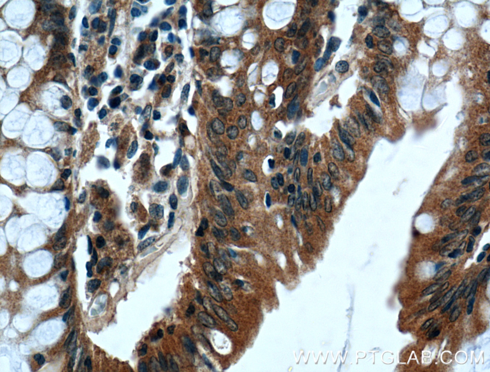 Immunohistochemistry (IHC) staining of human colon tissue using IFT22 Polyclonal antibody (26896-1-AP)
