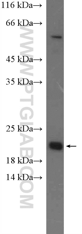 Western Blot (WB) analysis of HeLa cells using IFT22 Polyclonal antibody (26896-1-AP)