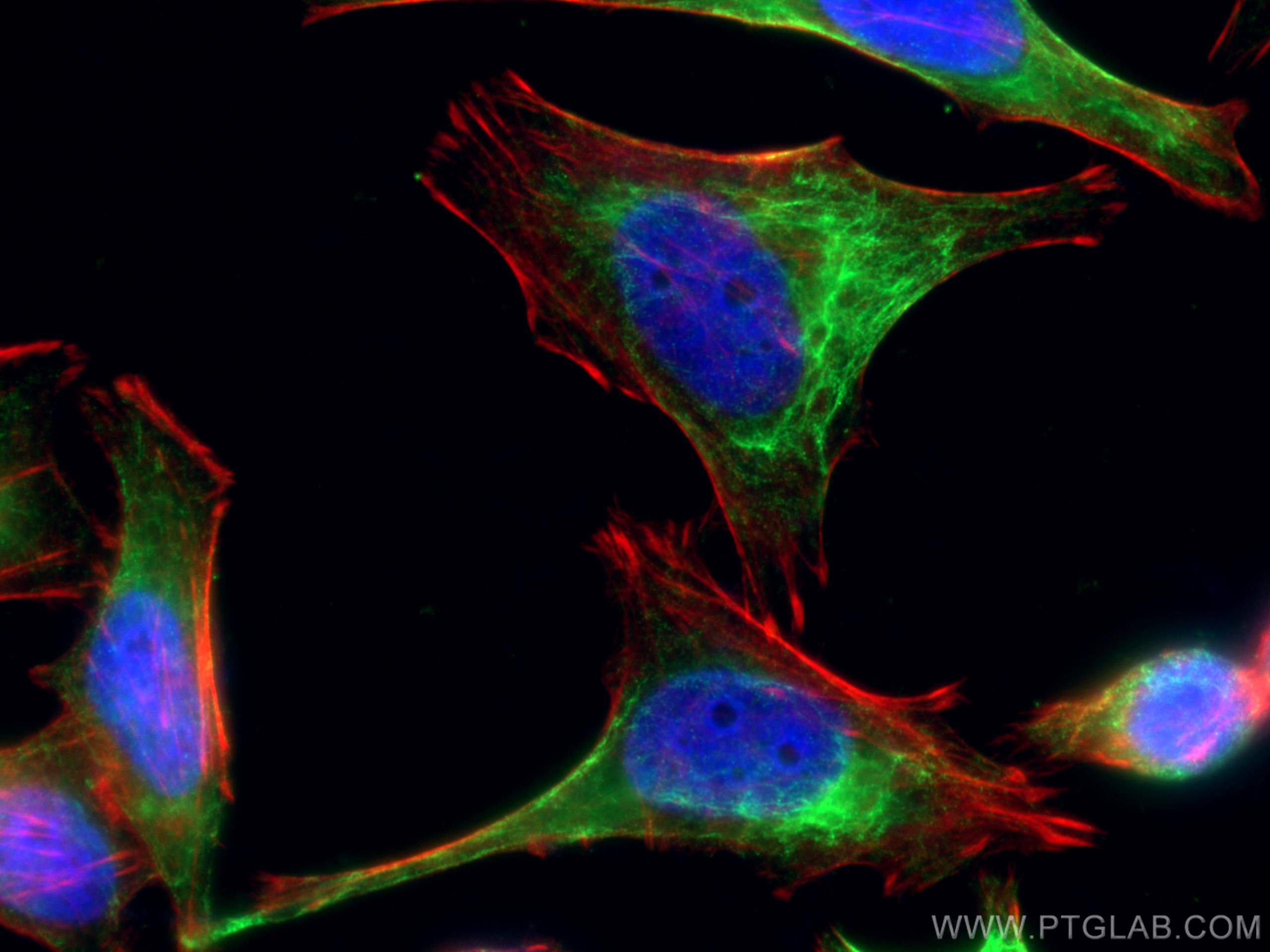 IF Staining of HeLa using 24072-1-AP