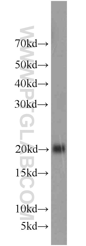 Western Blot (WB) analysis of human brain tissue using Rac1 Polyclonal antibody (24072-1-AP)