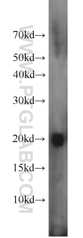 Western Blot (WB) analysis of human brain tissue using Rac1 Polyclonal antibody (24072-1-AP)