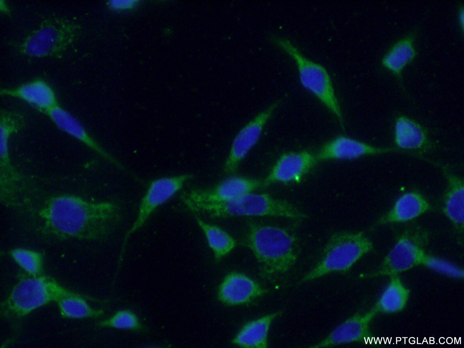 Immunofluorescence (IF) / fluorescent staining of NIH/3T3 cells using RAC1 Monoclonal antibody (66122-1-Ig)