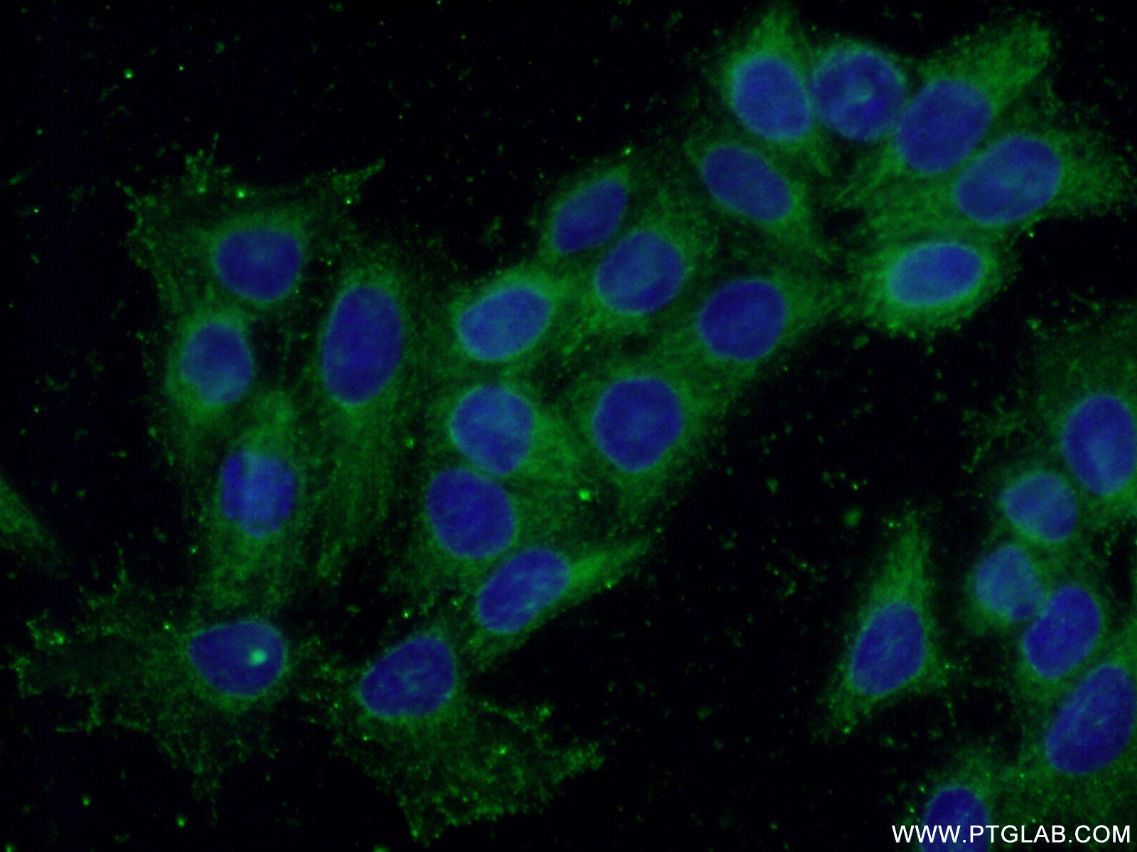 Immunofluorescence (IF) / fluorescent staining of HeLa cells using RAC1 Monoclonal antibody (66122-1-Ig)
