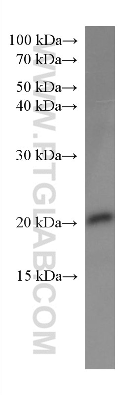 WB analysis of HeLa using 66122-1-Ig