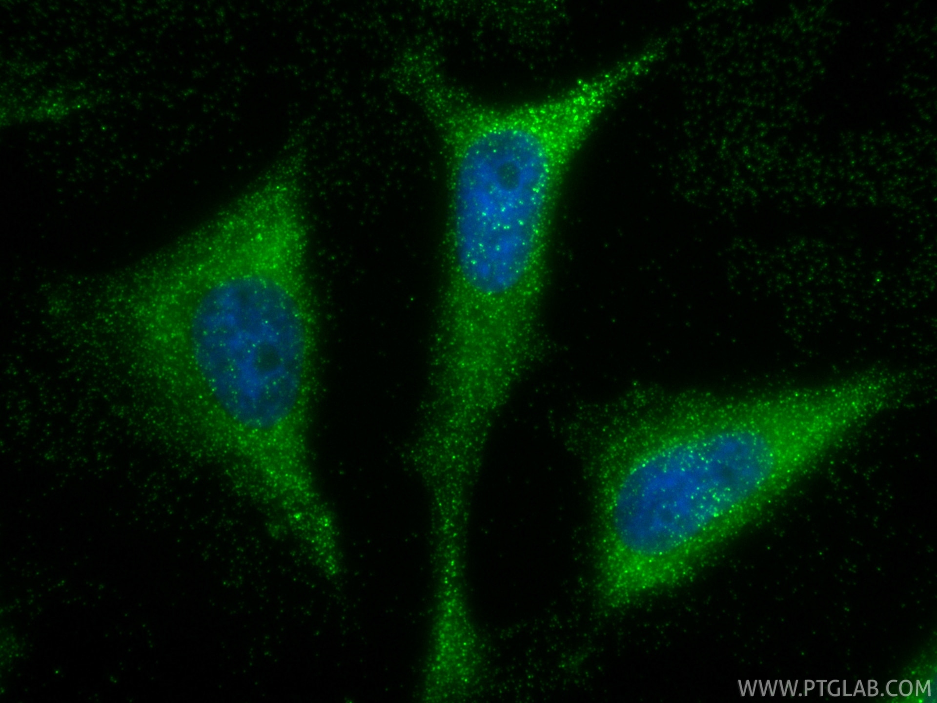 IF Staining of HeLa using 88471-1-RR Immunofluorescence (IF) / fluorescent staining of HeLa cells using RAC1 Recombinant monoclonal antibody (88471-1-RR)