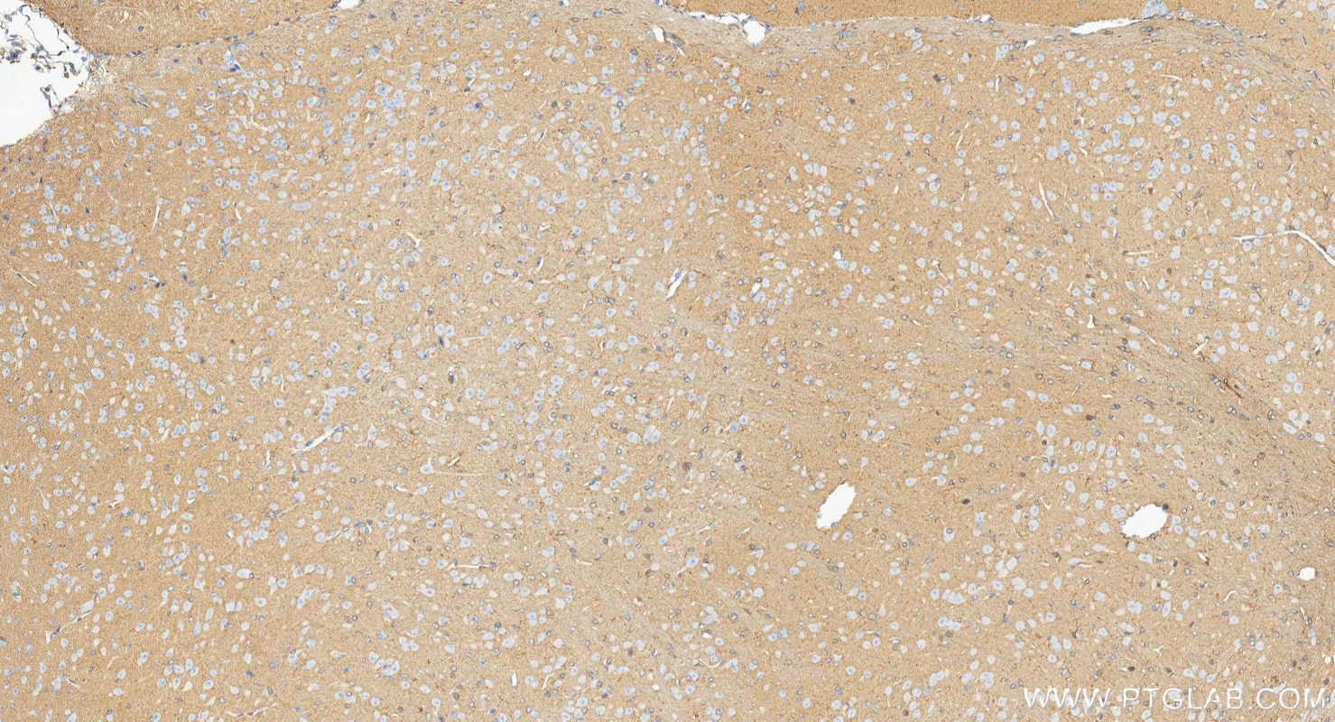 IHC staining of mouse brain using 88471-1-RR Immunohistochemistry (IHC) staining of mouse brain tissue using RAC1 Recombinant monoclonal antibody (88471-1-RR)