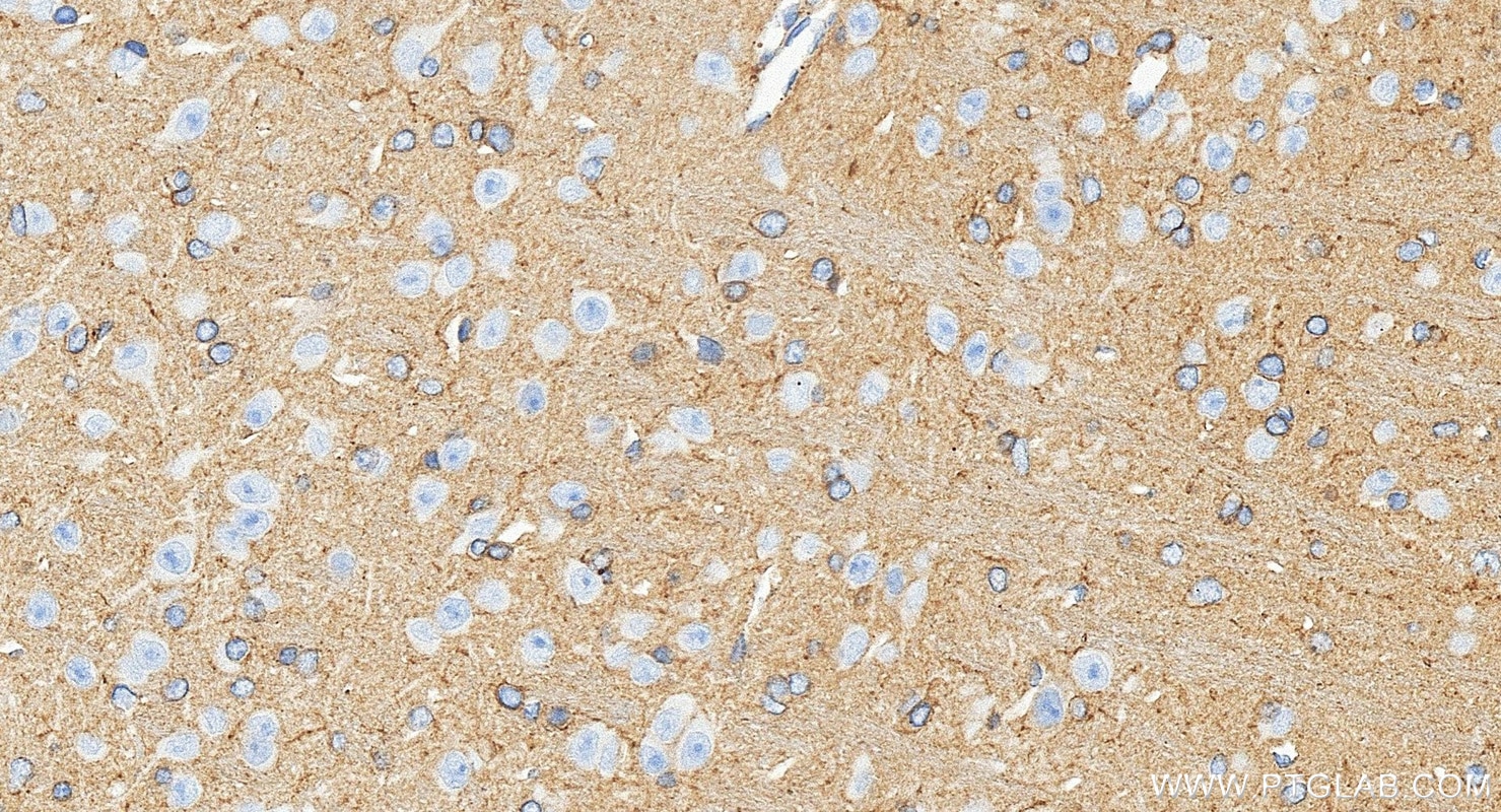 IHC staining of mouse brain using 88471-1-RR Immunohistochemistry (IHC) staining of mouse brain tissue using RAC1 Recombinant monoclonal antibody (88471-1-RR)