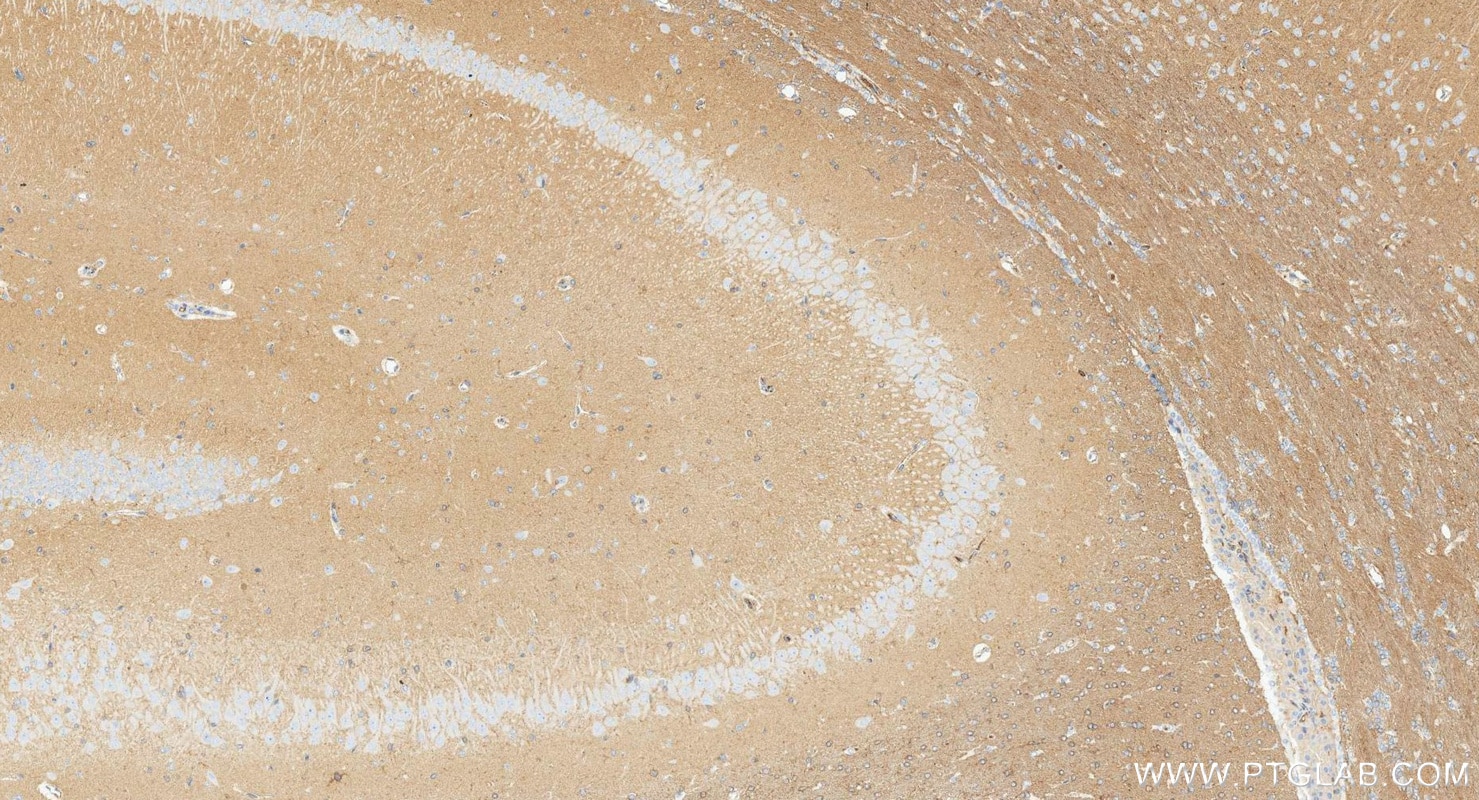 IHC staining of rat brain using 88471-1-RR Immunohistochemistry (IHC) staining of rat brain tissue using RAC1 Recombinant monoclonal antibody (88471-1-RR)