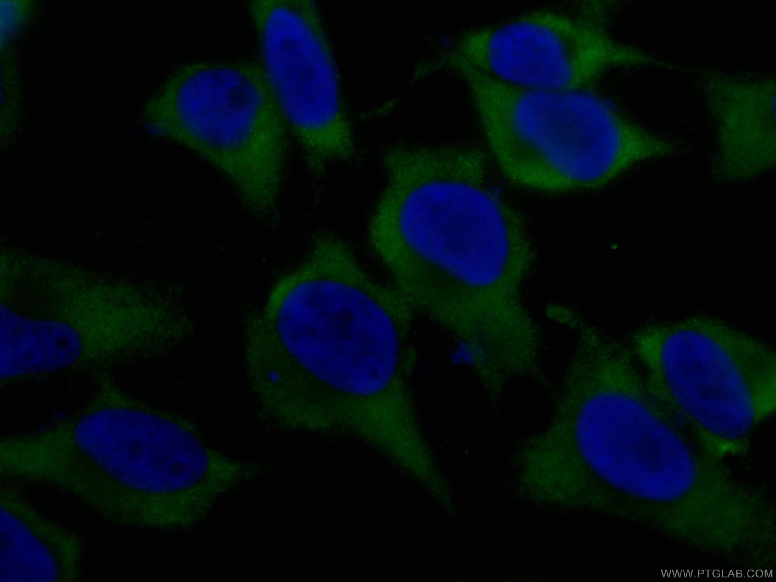 Immunofluorescence (IF) / fluorescent staining of HeLa cells using CoraLite® Plus 488-conjugated RAC1 Monoclonal anti (CL488-66122)