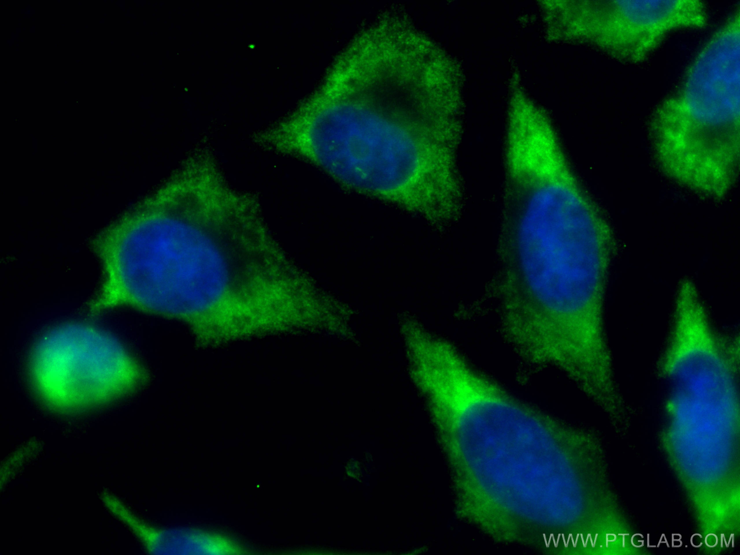 Immunofluorescence (IF) / fluorescent staining of HeLa cells using CoraLite® Plus 488-conjugated RAC1 Monoclonal anti (CL488-66122)