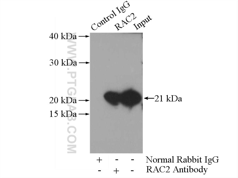 Immunoprecipitation (IP) experiment of HL-60 cells using RAC2 Polyclonal antibody (10735-1-AP)