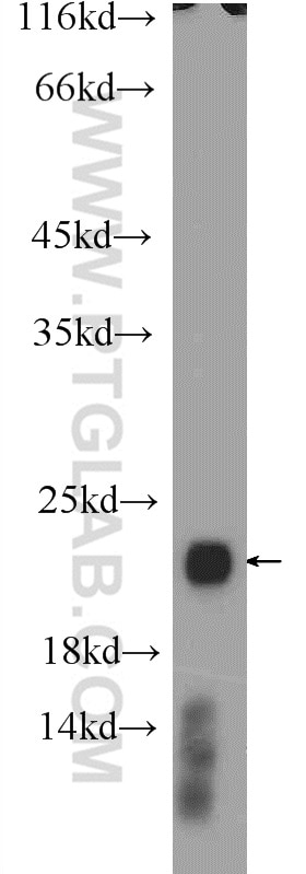 RAC2 Polyclonal antibody