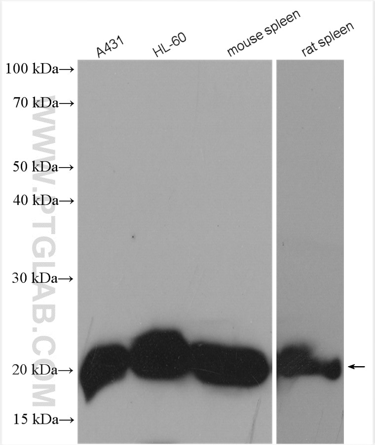 Western Blot (WB) analysis of various lysates using RAC2 Polyclonal antibody (10735-1-AP)
