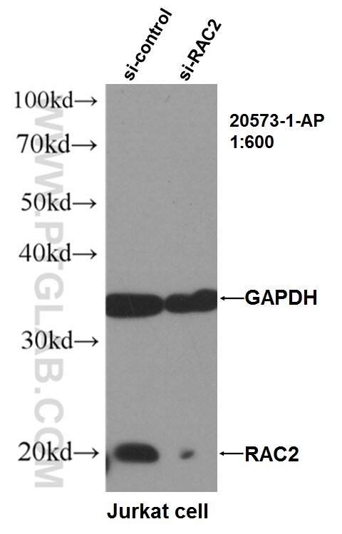 Western Blot (WB) analysis of Jurkat cells using RAC2 Polyclonal antibody (20573-1-AP)