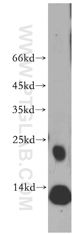 Western Blot (WB) analysis of HL-60 cells using RAC2 Polyclonal antibody (20573-1-AP)
