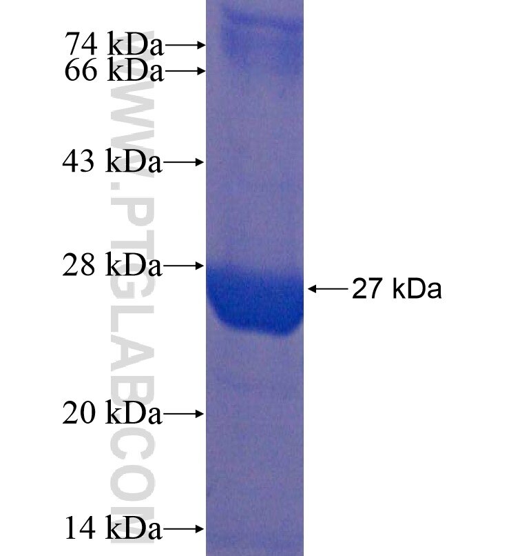 RAC2 fusion protein Ag16663 SDS-PAGE