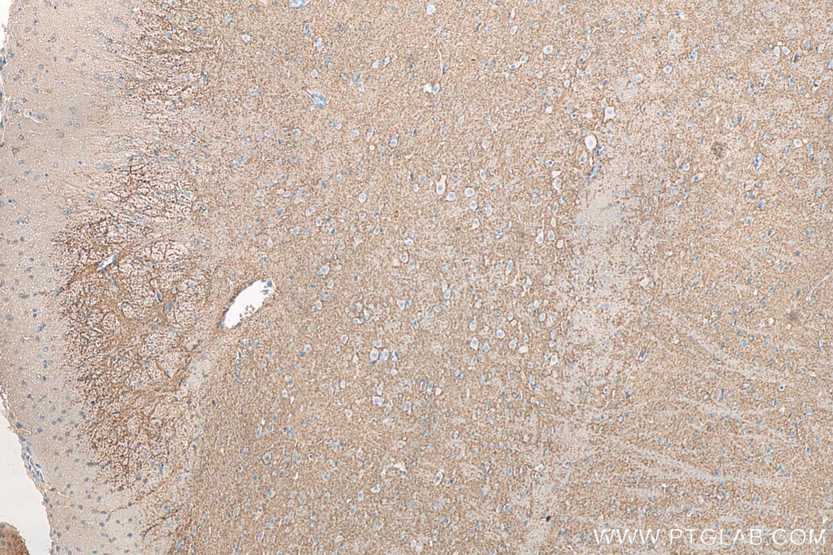 Immunohistochemistry (IHC) staining of mouse brain tissue using RAC1/2/3 Polyclonal antibody (16117-1-AP)