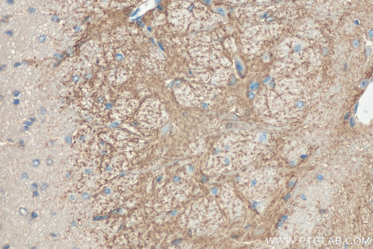 Immunohistochemistry (IHC) staining of mouse brain tissue using RAC1/2/3 Polyclonal antibody (16117-1-AP)