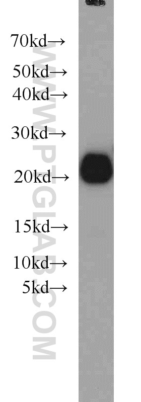 Western Blot (WB) analysis of human brain tissue using RAC1/2/3 Polyclonal antibody (16117-1-AP)