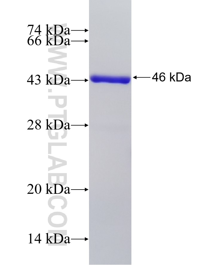 RAC1/2/3 fusion protein Ag9045 SDS-PAGE