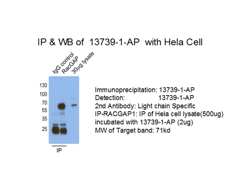 Immunoprecipitation (IP) experiment of HeLa cells using RACGAP1 Polyclonal antibody (13739-1-AP)