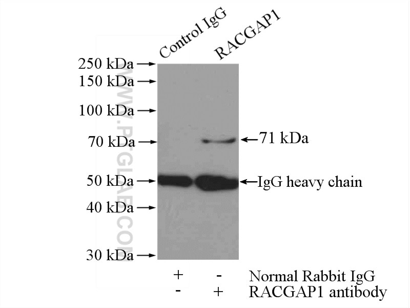 Immunoprecipitation (IP) experiment of mouse testis tissue using RACGAP1 Polyclonal antibody (13739-1-AP)