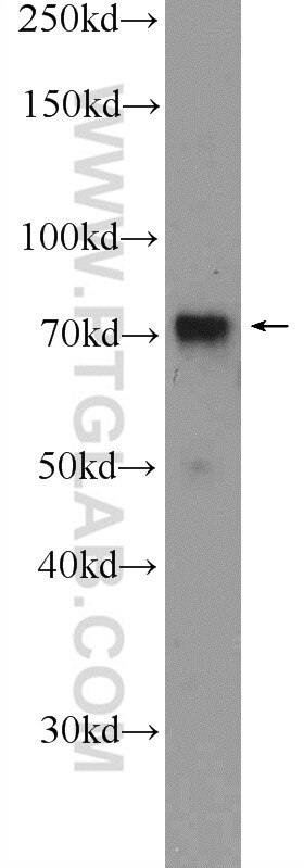 Western Blot (WB) analysis of K-562 cells using RACGAP1 Polyclonal antibody (13739-1-AP)