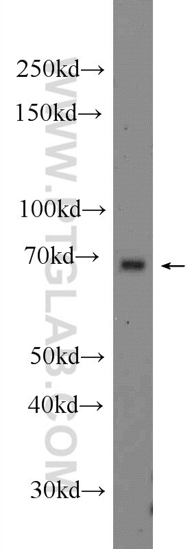 Western Blot (WB) analysis of RAW 264.7 cells using RACGAP1 Polyclonal antibody (13739-1-AP)