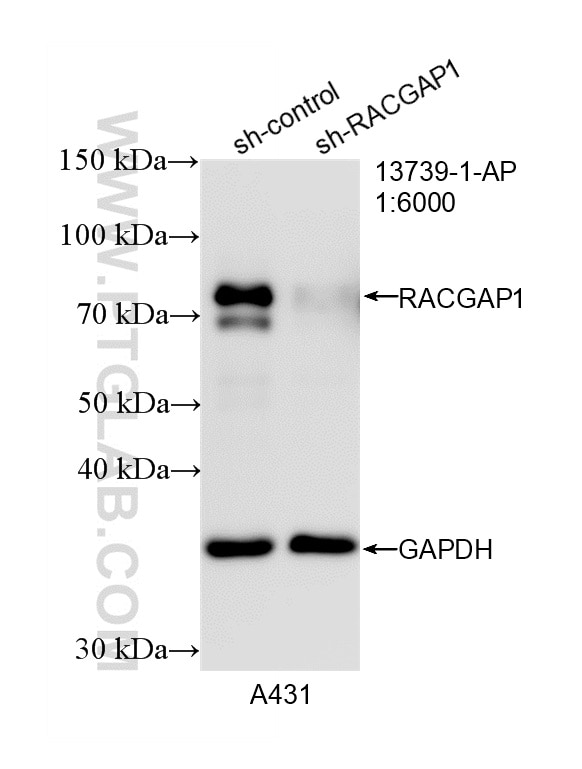 WB analysis of A431 using 13739-1-AP Western Blot (WB) analysis of A431 cells using RACGAP1 Polyclonal antibody (13739-1-AP)