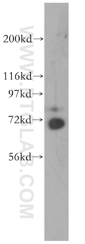 Western Blot (WB) analysis of mouse testis tissue using RACGAP1 Polyclonal antibody (13739-1-AP)