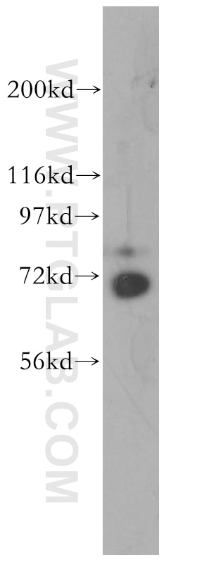 WB analysis of mouse testis using 13739-1-AP