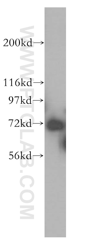 Western Blot (WB) analysis of HeLa cells using RACGAP1 Polyclonal antibody (13739-1-AP)