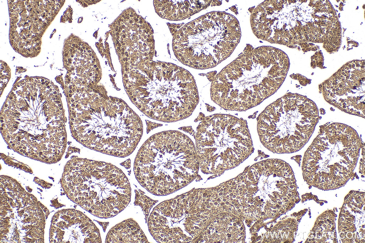 Immunohistochemistry (IHC) staining of mouse testis tissue using RACGAP1 Polyclonal antibody (30042-1-AP)