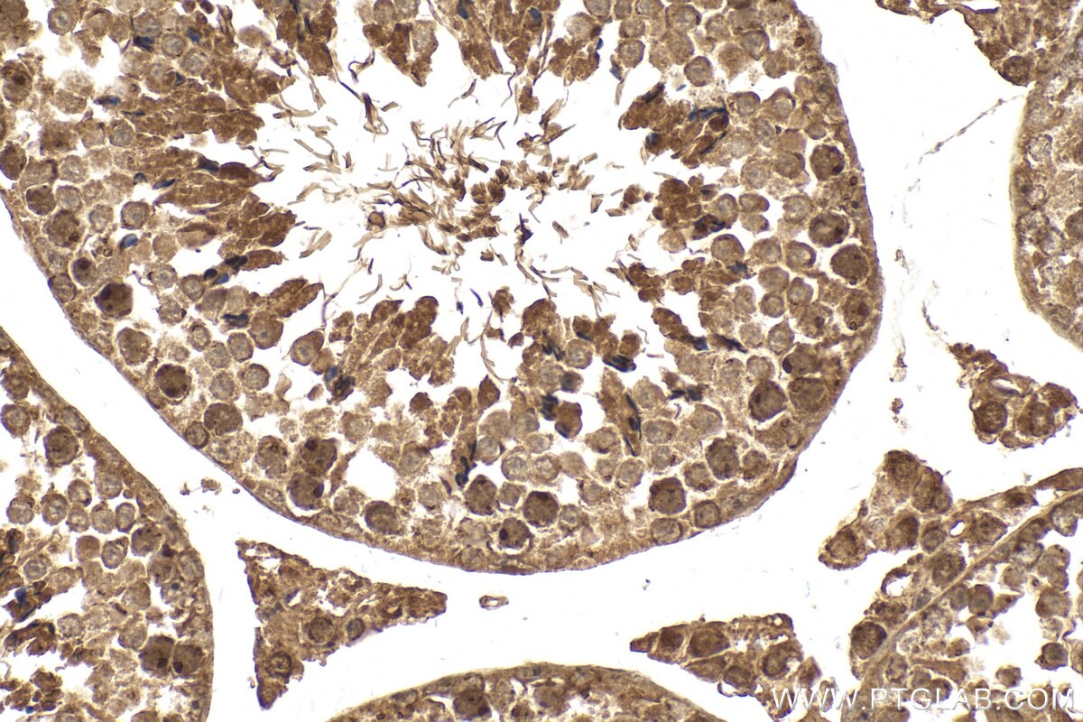 Immunohistochemistry (IHC) staining of mouse testis tissue using RACGAP1 Polyclonal antibody (30042-1-AP)