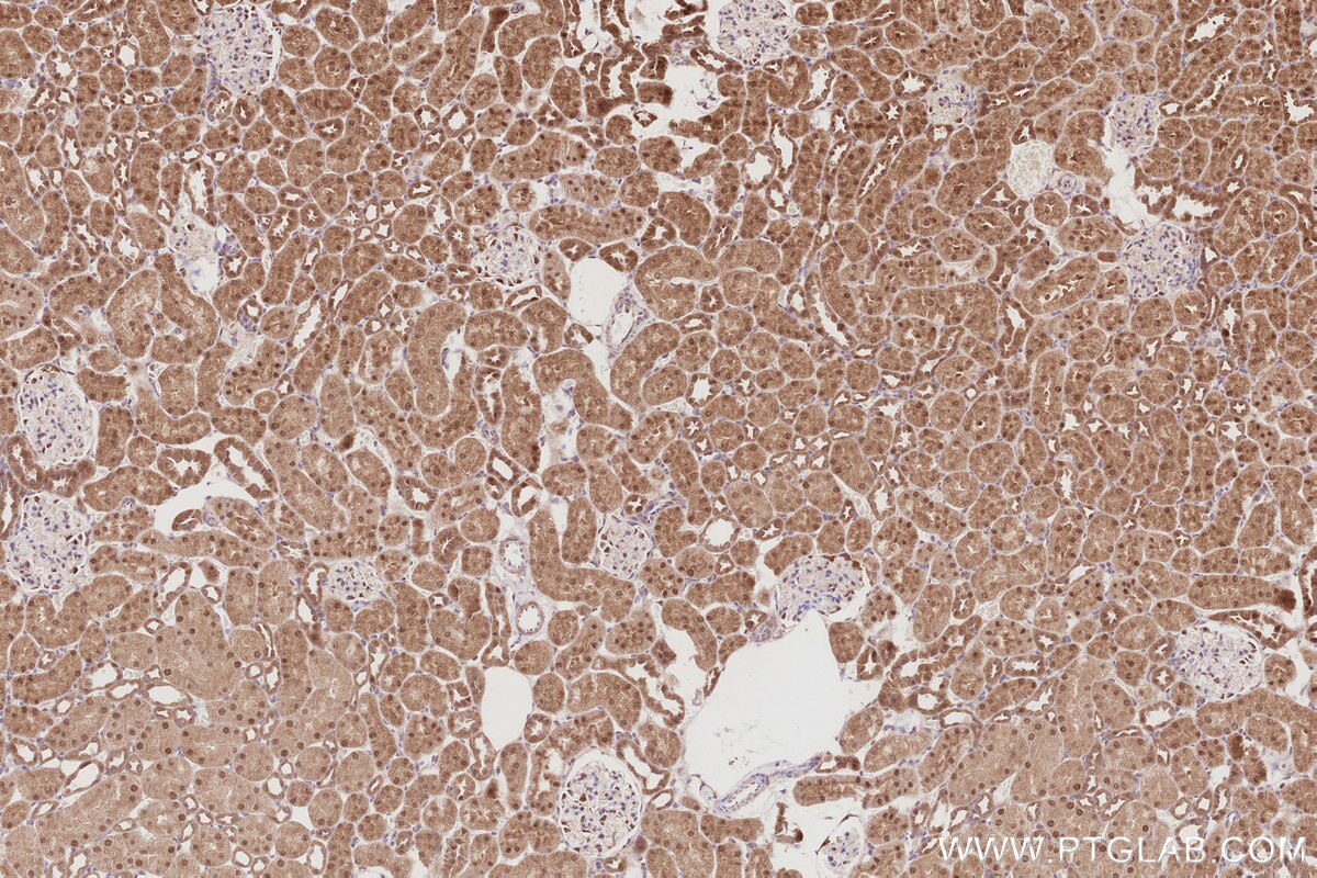IHC staining of rat kidney using 30042-1-AP Immunohistochemistry (IHC) staining of rat kidney tissue using RACGAP1 Polyclonal antibody (30042-1-AP)