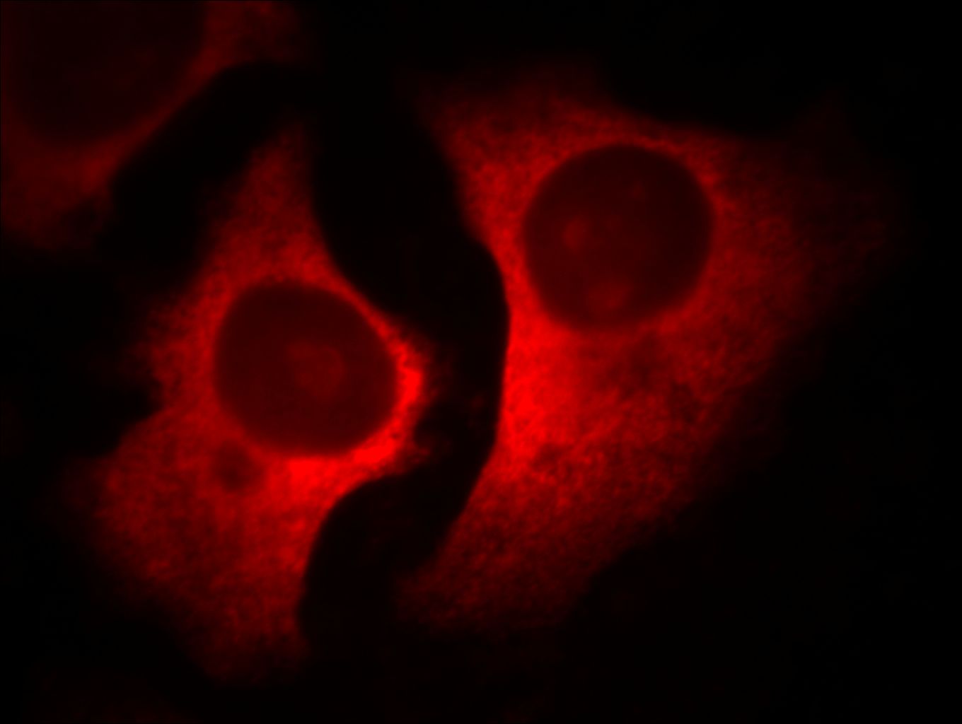 Immunofluorescence (IF) / fluorescent staining of HeLa cells using RACGAP1 Monoclonal antibody (66056-1-Ig)
