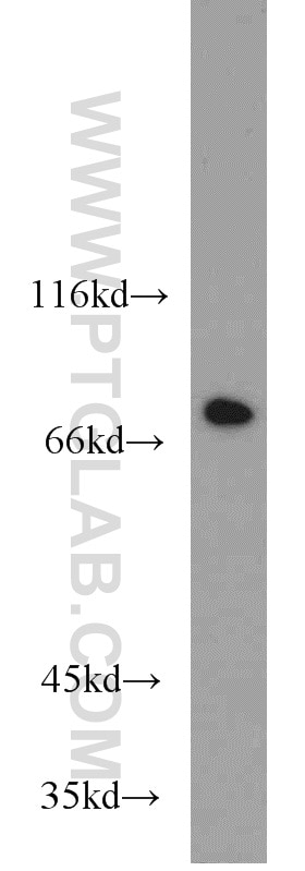 Western Blot (WB) analysis of human brain tissue using RACGAP1 Monoclonal antibody (66056-1-Ig)