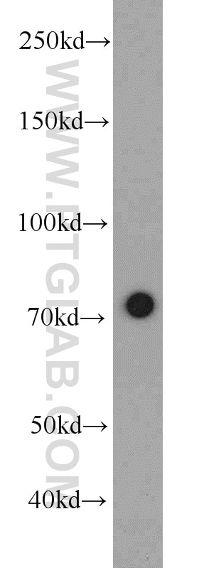Western Blot (WB) analysis of HeLa cells using RACGAP1 Monoclonal antibody (66056-1-Ig)