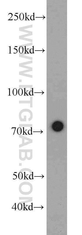 Western Blot (WB) analysis of HeLa cells using RACGAP1 Monoclonal antibody (66056-1-Ig)