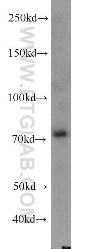 Western Blot (WB) analysis of HEK-293 cells using RACGAP1 Monoclonal antibody (66056-1-Ig)