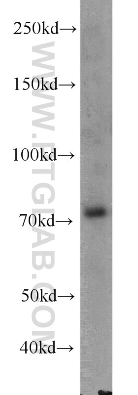 Western Blot (WB) analysis of HEK-293 cells using RACGAP1 Monoclonal antibody (66056-1-Ig)