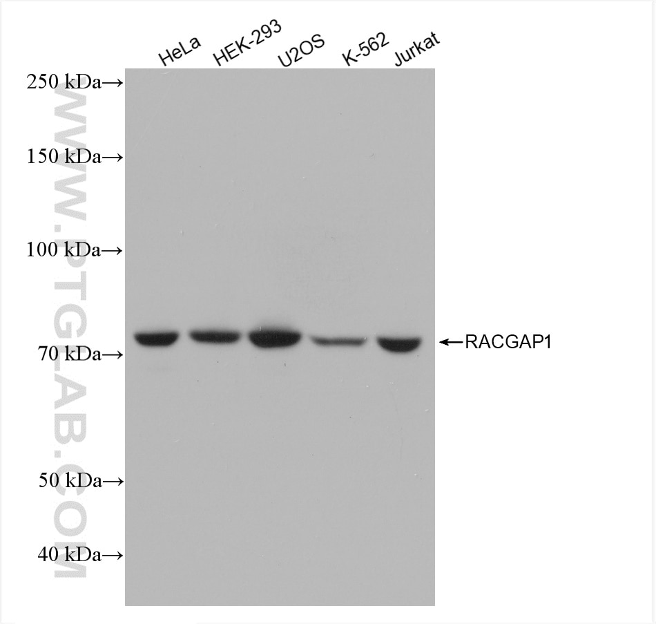 Western Blot (WB) analysis of various lysates using RACGAP1 Recombinant antibody (82788-1-RR)