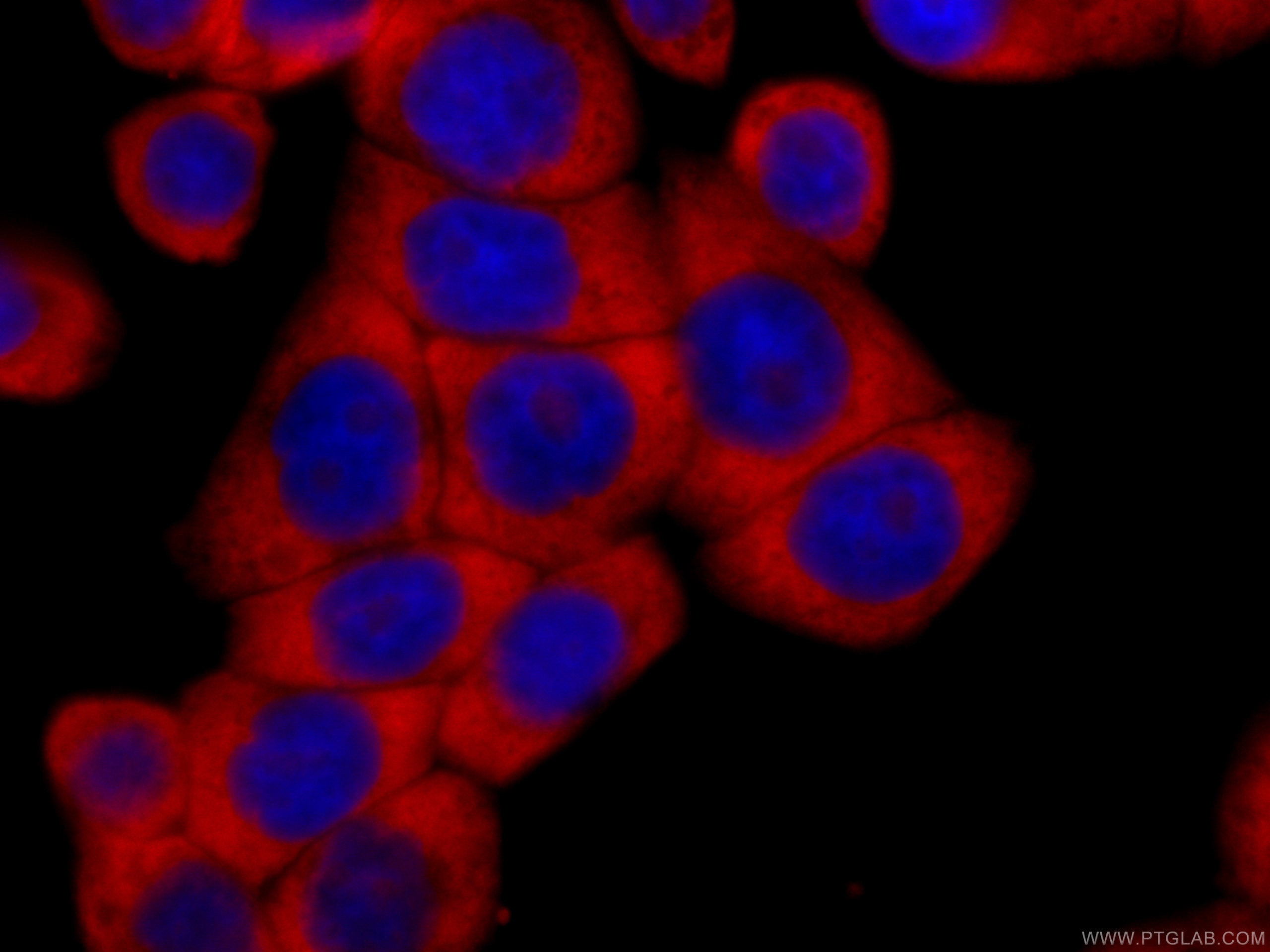 Immunofluorescence (IF) / fluorescent staining of HeLa cells using CoraLite®594-conjugated RACGAP1 Monoclonal antibod (CL594-66056)