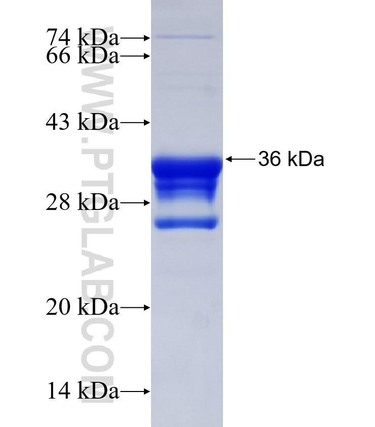 RACGAP1 fusion protein Ag32468 SDS-PAGE